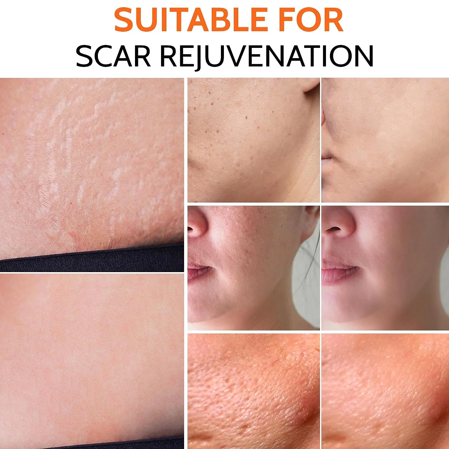 Adjustable Derma Stamp with Titanium Needles - Image 5